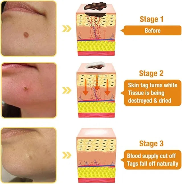 Tower 28 Beauty SOS Daily Skin Barrier Redness Recovery Moisturizer