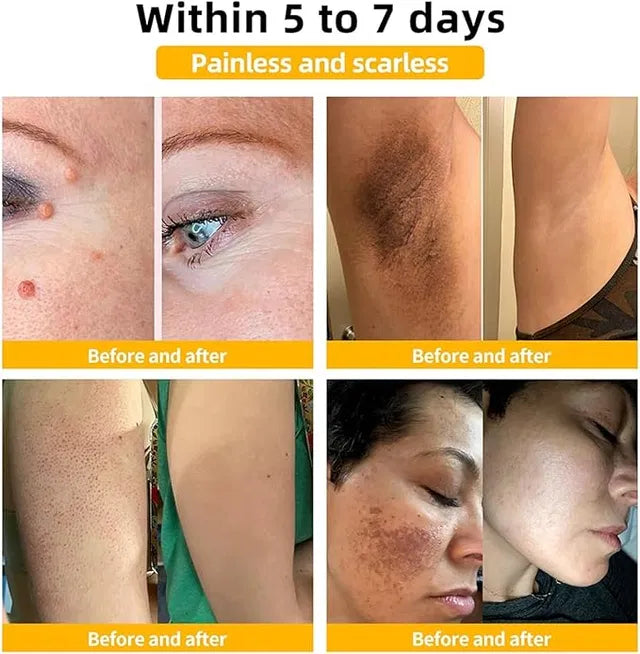 Tower 28 Beauty SOS Daily Skin Barrier Redness Recovery Moisturizer